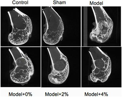 Bioinspired Protein/Peptide Loaded 3D Printed PLGA Scaffold Promotes Bone Regeneration